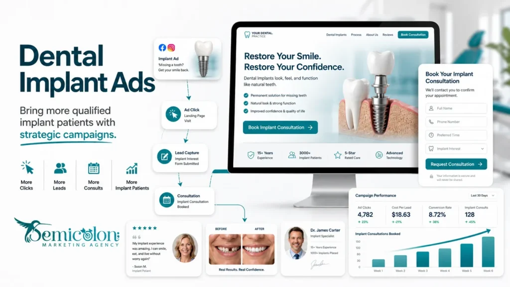 Dental implant ads strategy showing Google Ads campaign flow from ad click to landing page, lead capture, consultation booking, and campaign performance.