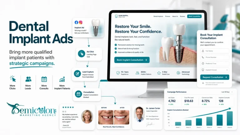 Dental implant ads strategy showing Google Ads campaign flow from ad click to landing page, lead capture, consultation booking, and campaign performance.